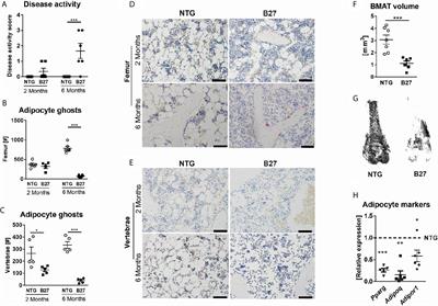 Rodent Models of Spondyloarthritis Have Decreased White and Bone Marrow Adipose Tissue Depots